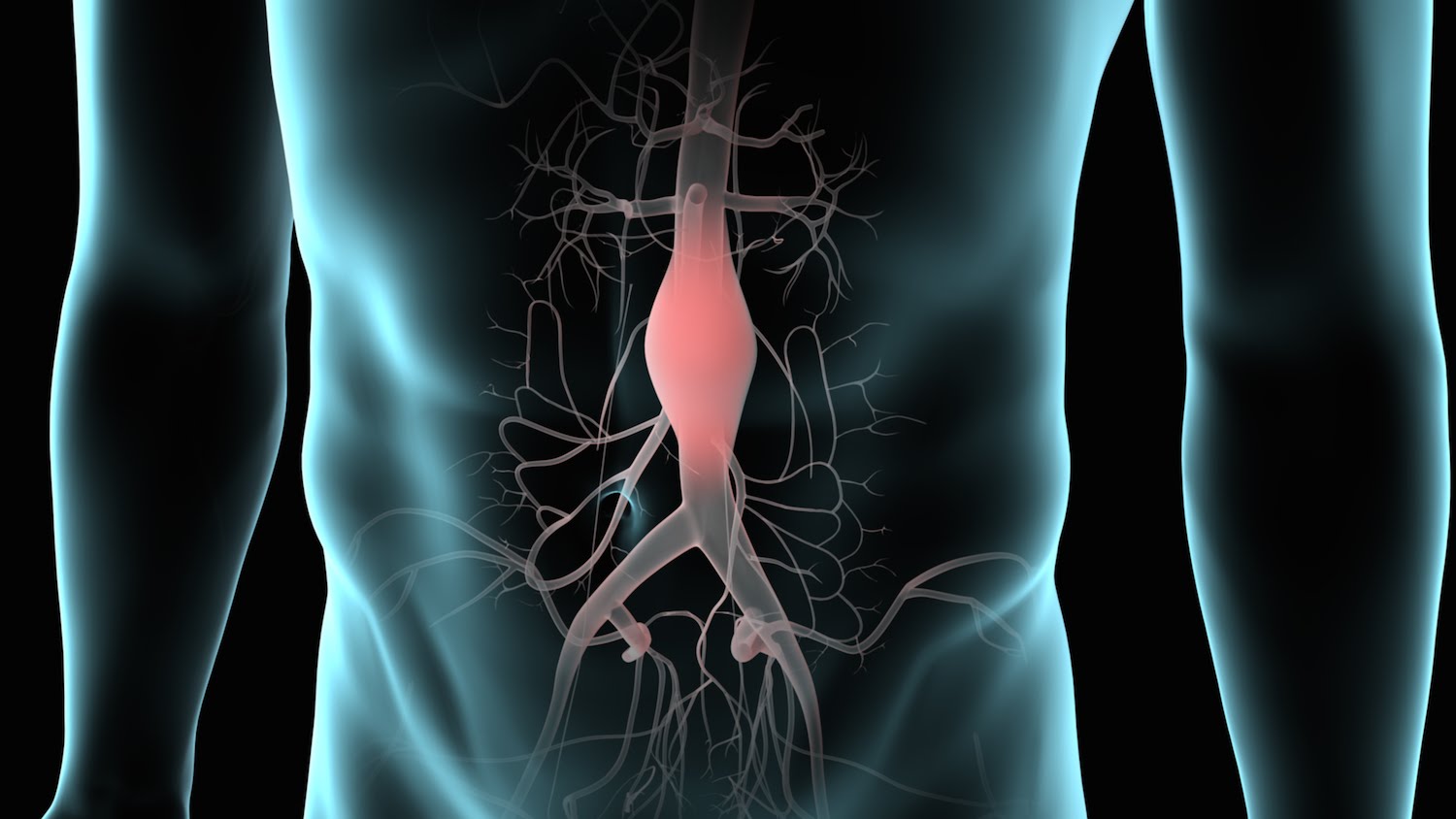 Jak poznat výduť aorty?